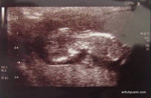 12 week ultrasound